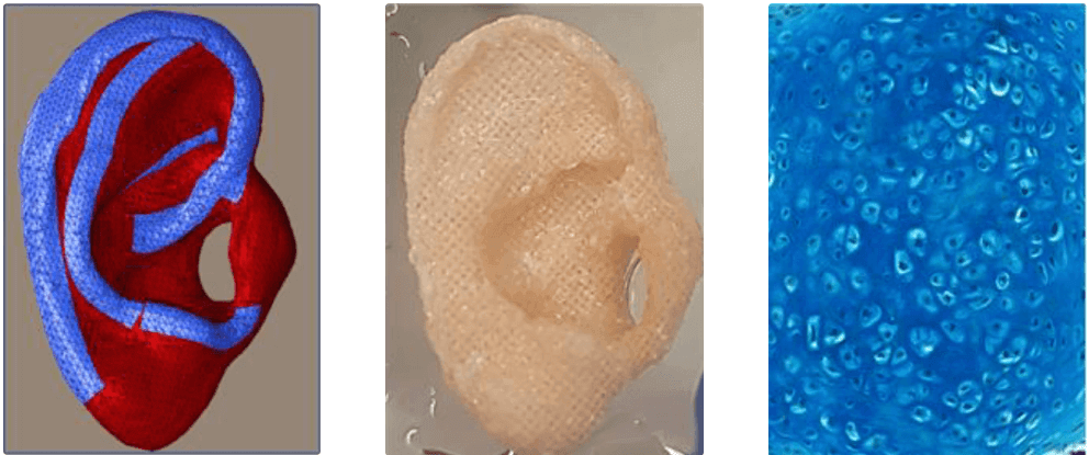 метод реконструкции уха