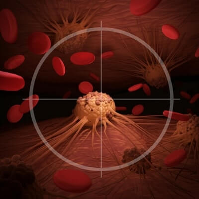 Лечение лейкемии CAR-T клетками